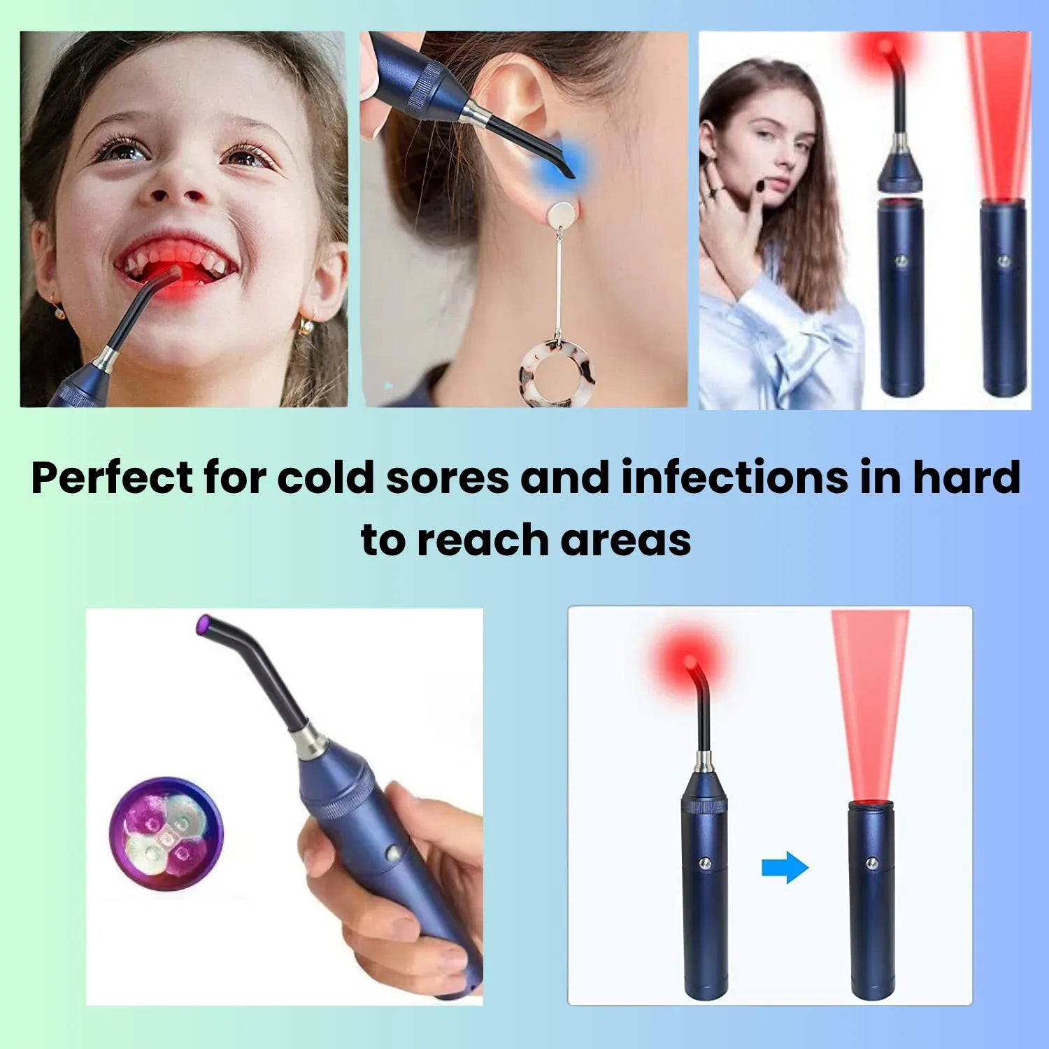 Red light therapy pen for treating cold sores, acne, and infections in hard-to-reach areas
